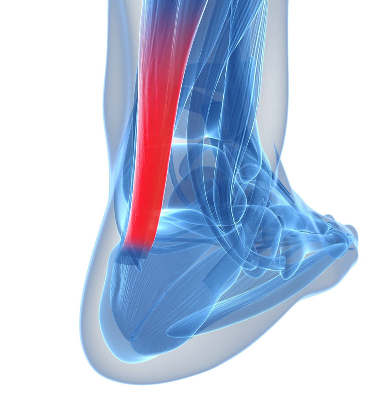 ACHILLES TENDONITIS/ TENDONOPATHY FACTS AND ADVICE