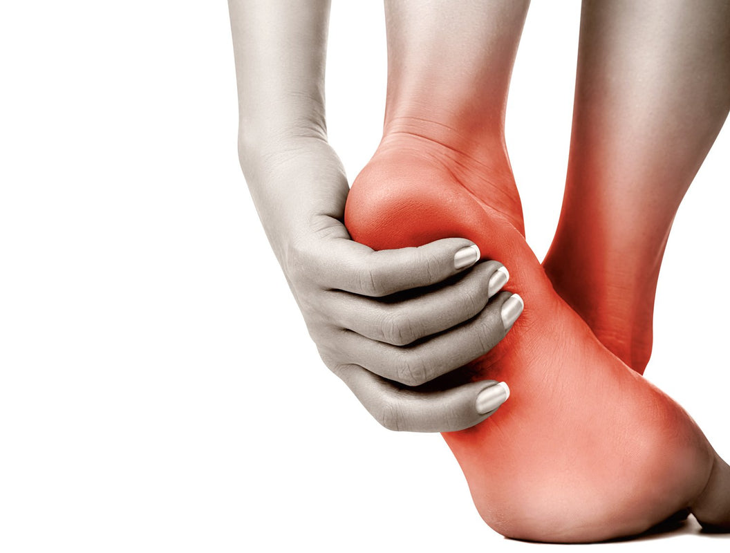 PLANTAR FASCIITIS FACTS AND ADVICE